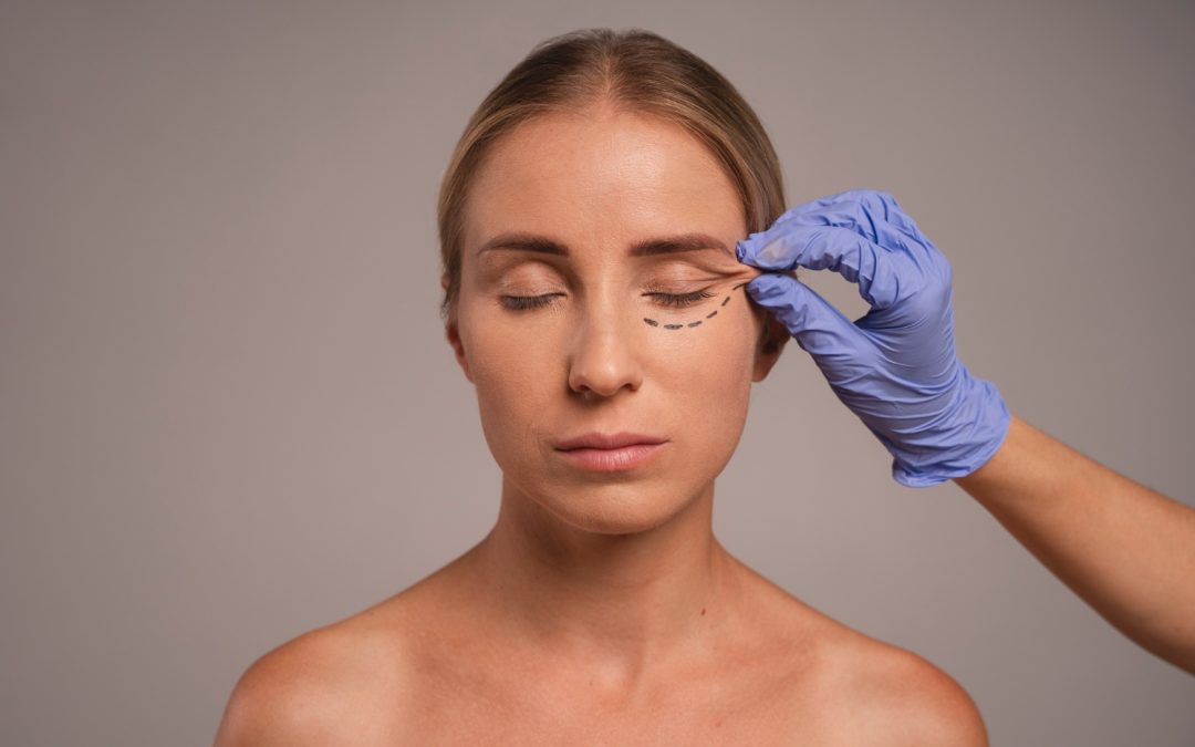 woman preparing for eyelid surgery