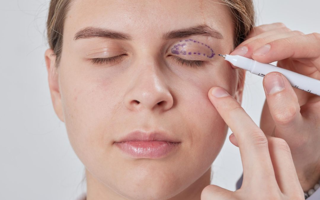 eyelid surgery