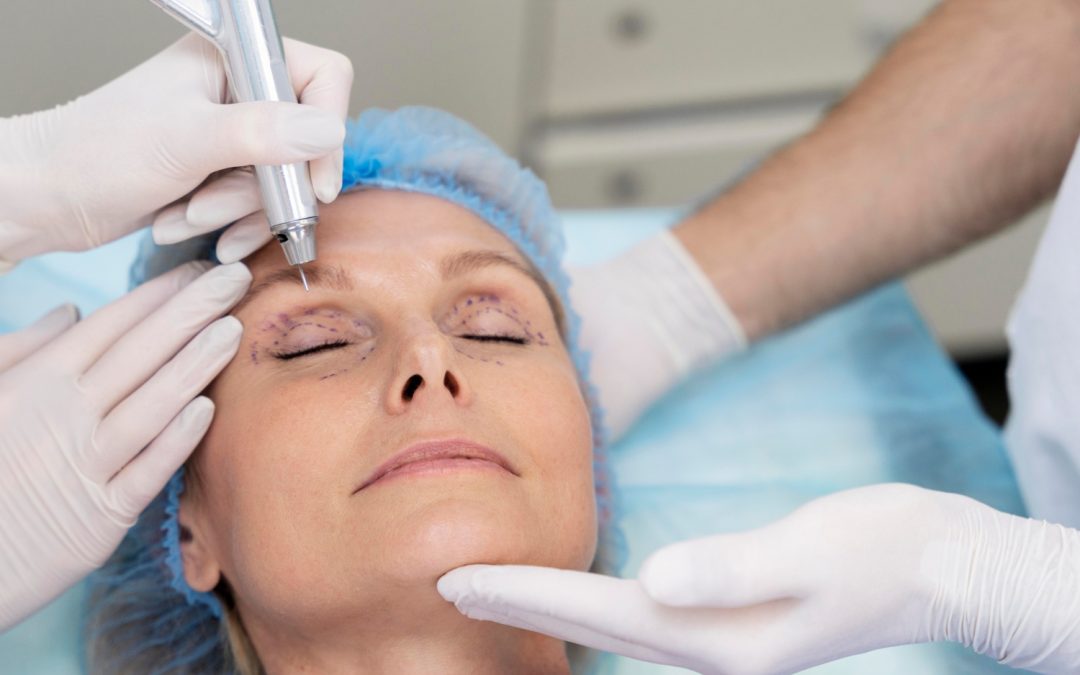 eyelid surgery