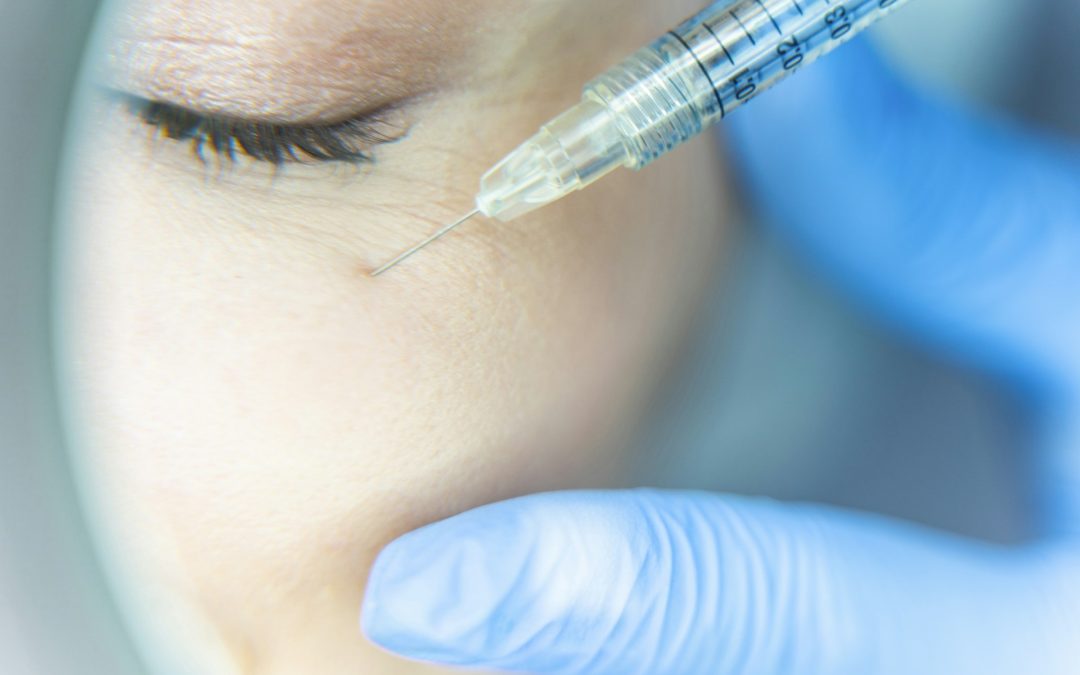 blepharoplasty